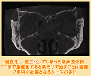 慢性化することの危険性